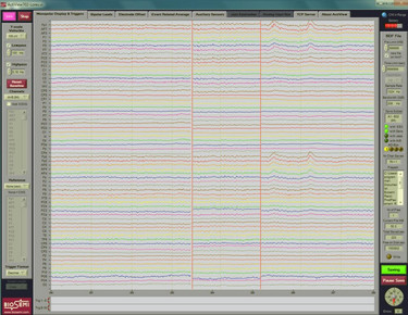 Part of a 64-channel EEG spectrum for objective and controlled recording of the reaction of the human brain, e.g. to contact with textiles. ©The Neuromarketing Labs 